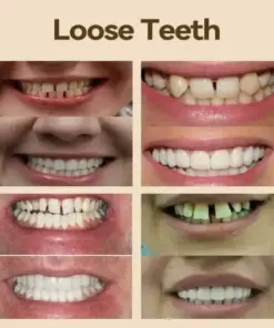 𝐇𝐢𝐝𝐨𝐧𝐞® – 𝐏𝐫𝐞𝐦𝐢𝐮𝐦 𝐃𝐞𝐧𝐭𝐮𝐫𝐞