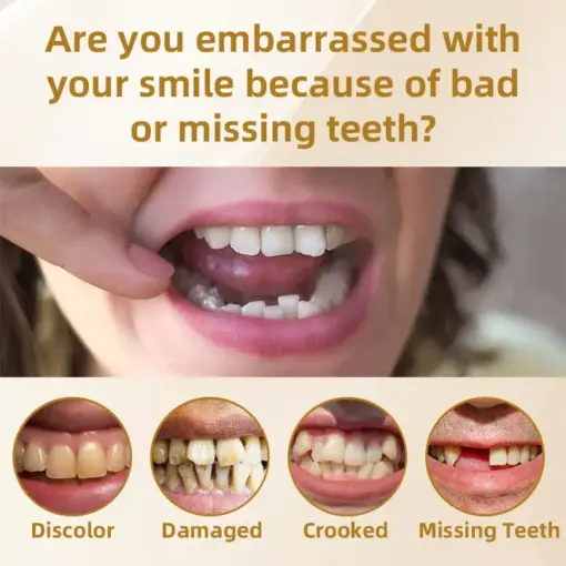 Hidone® --🦷Advanced Customized Full Denture Set🦷 (⏰Limited time discount last 30 minutes⏰)💎💎